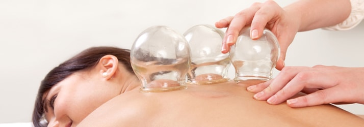 Chiropractic Woodbury MN Cupping Treatment
